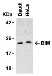 Anti-Bim antibody used in Western Blot (WB). GTX31697