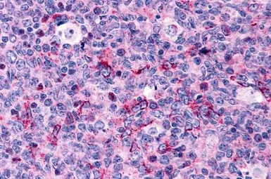 Anti-Caspase 3 antibody used in IHC (Paraffin sections) (IHC-P). GTX31698