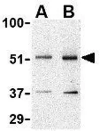 Anti-TANK antibody used in Western Blot (WB). GTX31741