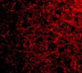 Anti-Stathmin 1 antibody used in IHC (Paraffin sections) (IHC-P). GTX31760