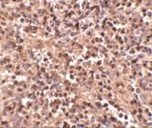 Anti-ATG5 antibody used in IHC (Paraffin sections) (IHC-P). GTX31770