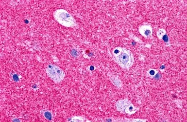 Anti-RIM2 antibody used in IHC (Paraffin sections) (IHC-P). GTX31772