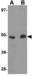 Anti-FOXO4 antibody used in Western Blot (WB). GTX31807