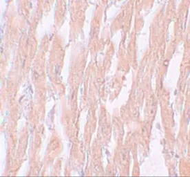 Anti-KPNA2 antibody used in IHC (Paraffin sections) (IHC-P). GTX31812