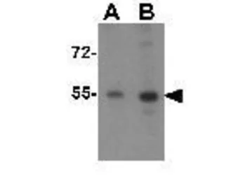 Anti-KPNA2 antibody used in Western Blot (WB). GTX31812
