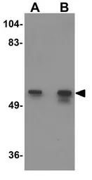 Anti-KPNA2 antibody used in Western Blot (WB). GTX31812