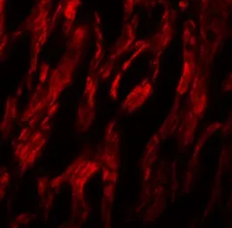Anti-ATG9A antibody used in IHC (Paraffin sections) (IHC-P). GTX31815