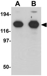 Anti-ZNF198 antibody used in Western Blot (WB). GTX31821