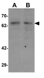 Anti-DYRK2 antibody used in Western Blot (WB). GTX31833
