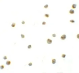 Anti-DYRK2 antibody used in Immunocytochemistry/ Immunofluorescence (ICC/IF). GTX31833