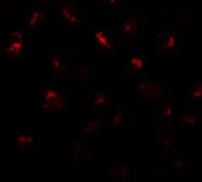 Anti-Protor-2 antibody used in Immunocytochemistry/ Immunofluorescence (ICC/IF). GTX31835
