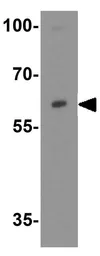 Anti-ZFX antibody used in Western Blot (WB). GTX31851