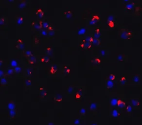 Anti-Dectin-1 antibody used in Immunocytochemistry/ Immunofluorescence (ICC/IF). GTX31853