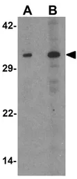 Anti-p57 Kip2 antibody used in Western Blot (WB). GTX31859