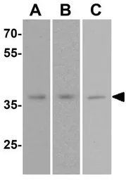 Anti-MECR antibody used in Western Blot (WB). GTX31866
