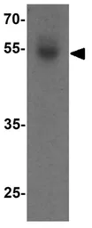 Anti-FOXA2 antibody used in Western Blot (WB). GTX31875