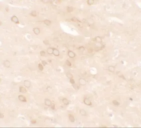 Anti-Estrogen Receptor alpha antibody used in IHC (Paraffin sections) (IHC-P). GTX31883
