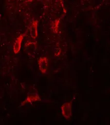 Anti-Estrogen Receptor alpha antibody used in IHC (Paraffin sections) (IHC-P). GTX31883
