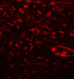 Anti-Osteopontin antibody used in IHC (Paraffin sections) (IHC-P). GTX31886