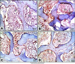Anti-Osteopontin antibody used in IHC (Paraffin sections) (IHC-P). GTX31886