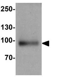 Anti-SUZ12 antibody used in Western Blot (WB). GTX31909