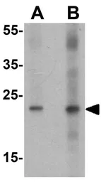 Anti-HMGB1 antibody used in Western Blot (WB). GTX31912
