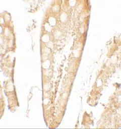 Anti-CFTR antibody used in IHC (Paraffin sections) (IHC-P). GTX31913