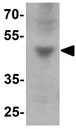 Anti-IFIT3 antibody used in Western Blot (WB). GTX31919