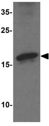 Anti-alpha Synuclein antibody used in Western Blot (WB). GTX31928