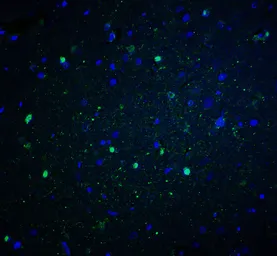 Anti-NOX2 / gp91phox antibody used in IHC (Paraffin sections) (IHC-P). GTX31930
