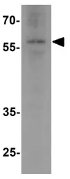 Anti-NOX2 / gp91phox antibody used in Western Blot (WB). GTX31930