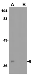 Anti-BATF3 antibody used in Western Blot (WB). GTX31933