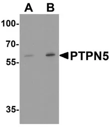 Anti-STEP / PTPN5 antibody used in Western Blot (WB). GTX31937