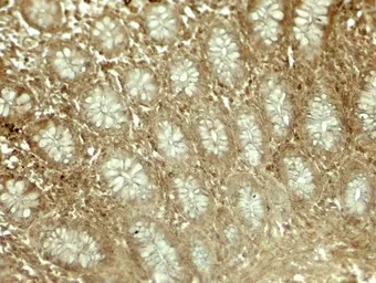 Anti-EPLIN antibody used in IHC (Paraffin sections) (IHC-P). GTX31940