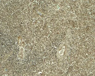 Anti-ATG4A antibody used in IHC (Paraffin sections) (IHC-P). GTX31941