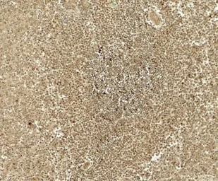 Anti-ATG4B antibody used in IHC (Paraffin sections) (IHC-P). GTX31942