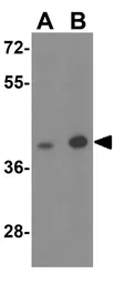 Anti-Adenosine A2b Receptor antibody used in Western Blot (WB). GTX31945