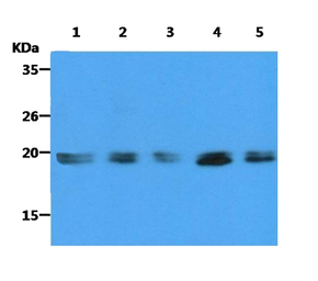 Anti-Ras antibody [AT2F8] used in Western Blot (WB). GTX31957
