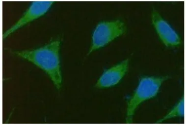 Anti-TBCEL antibody [AT1B10] used in Immunocytochemistry/ Immunofluorescence (ICC/IF). GTX31958