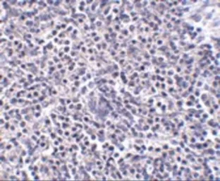 Anti-ARL15 antibody used in IHC (Paraffin sections) (IHC-P). GTX31973