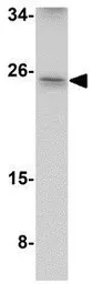 Anti-ARL15 antibody used in Western Blot (WB). GTX31973