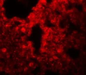 Anti-SRPX2 antibody used in IHC (Paraffin sections) (IHC-P). GTX31974