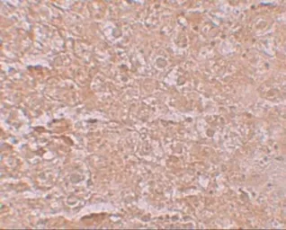 Anti-SLC39A14 antibody used in IHC (Paraffin sections) (IHC-P). GTX31996