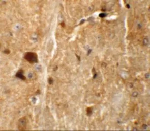 Anti-TMEM192 antibody used in IHC (Paraffin sections) (IHC-P). GTX32008