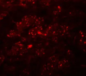 Anti-TMEM192 antibody used in IHC (Paraffin sections) (IHC-P). GTX32008