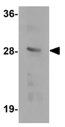 Anti-TMEM192 antibody used in Western Blot (WB). GTX32008