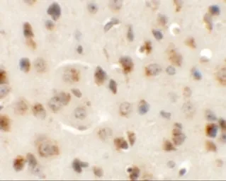 Anti-AP3M1 antibody used in IHC (Paraffin sections) (IHC-P). GTX32019