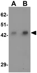 Anti-AP3M1 antibody used in Western Blot (WB). GTX32019