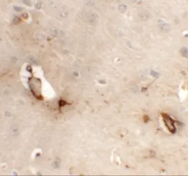 Anti-TMEM204 antibody used in IHC (Paraffin sections) (IHC-P). GTX32025