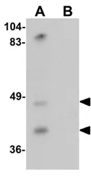 Anti-TMPRSS11A antibody used in Western Blot (WB). GTX32036